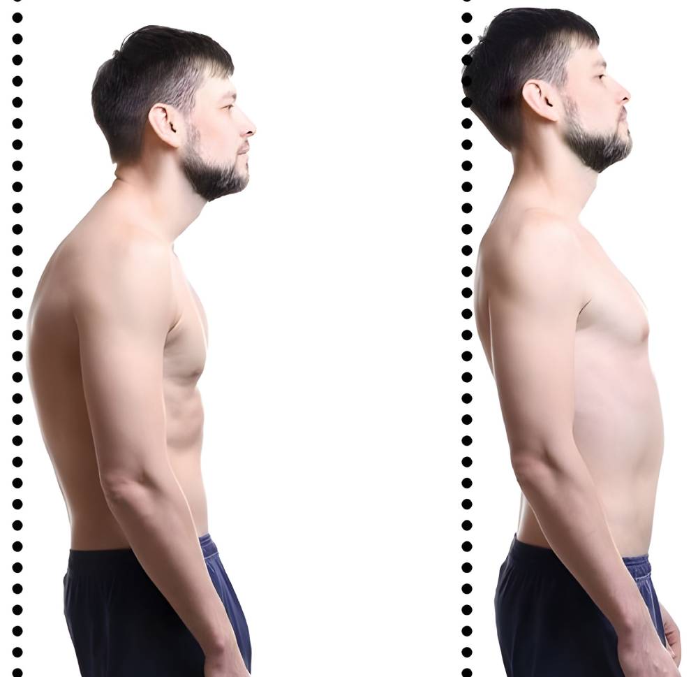 مشکلات ساختار قامتی